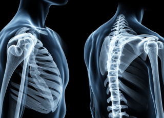 МРТ плечевого сустава Бирюлево