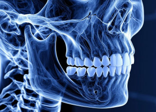 МРТ височно-челюстного сустава Бирюлево