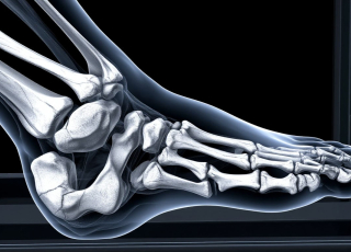 МРТ голеностопного сустава Бирюлево