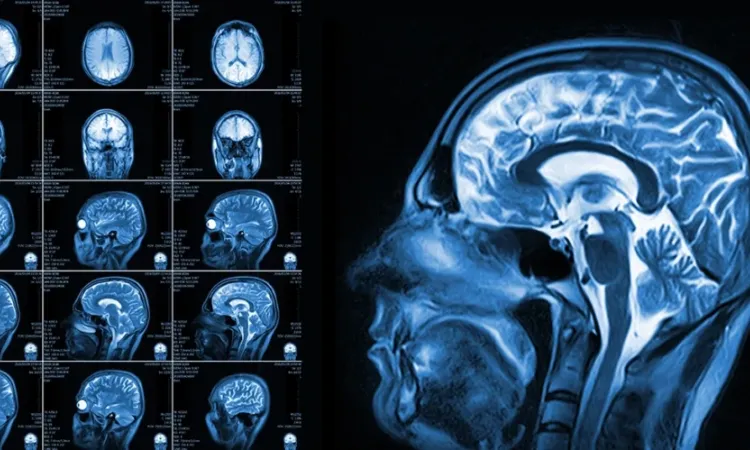 Снимок МРТ головвы в Бирюлево