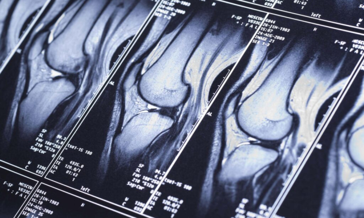 МРТ коленного сустава в Бирюлево