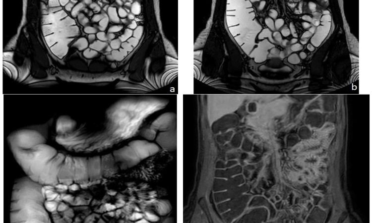 МРТ внутренних органов в Бирюлево