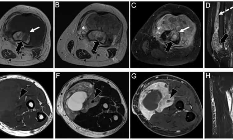 Снимок МРТ мягких тканей в Бирюлево